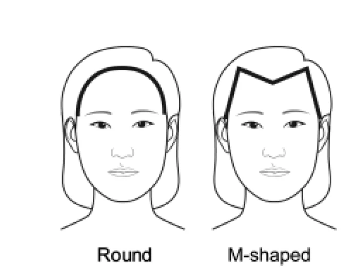 おでこの流行り：女性的な生え際とは？